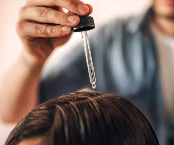 Dandruff Treatment